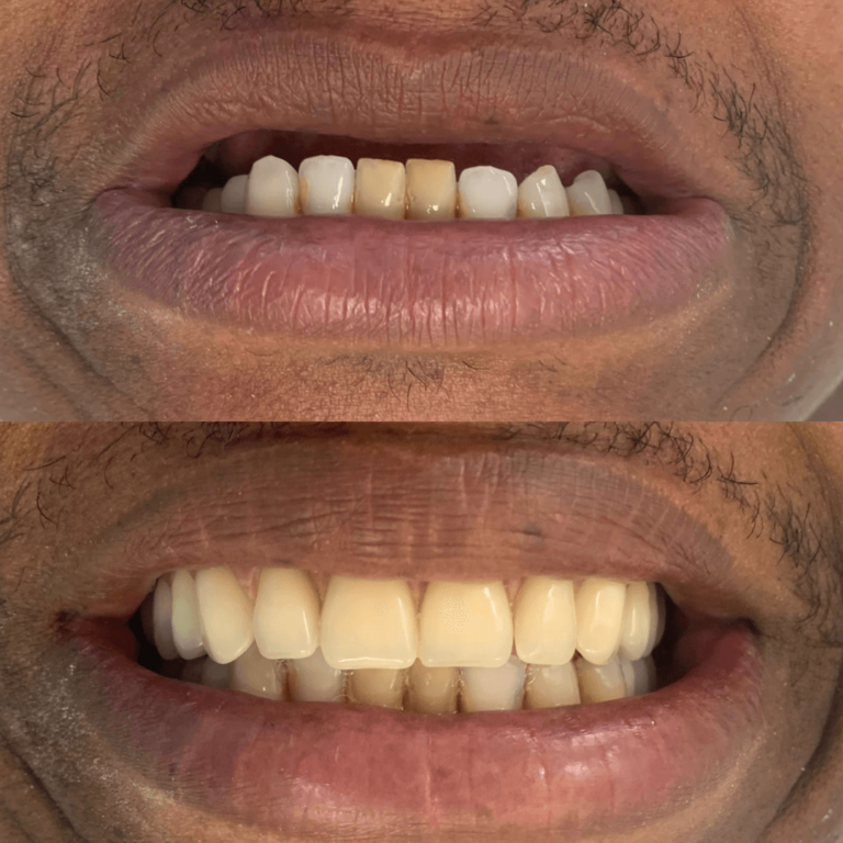 qwf49j2gmz-1.png